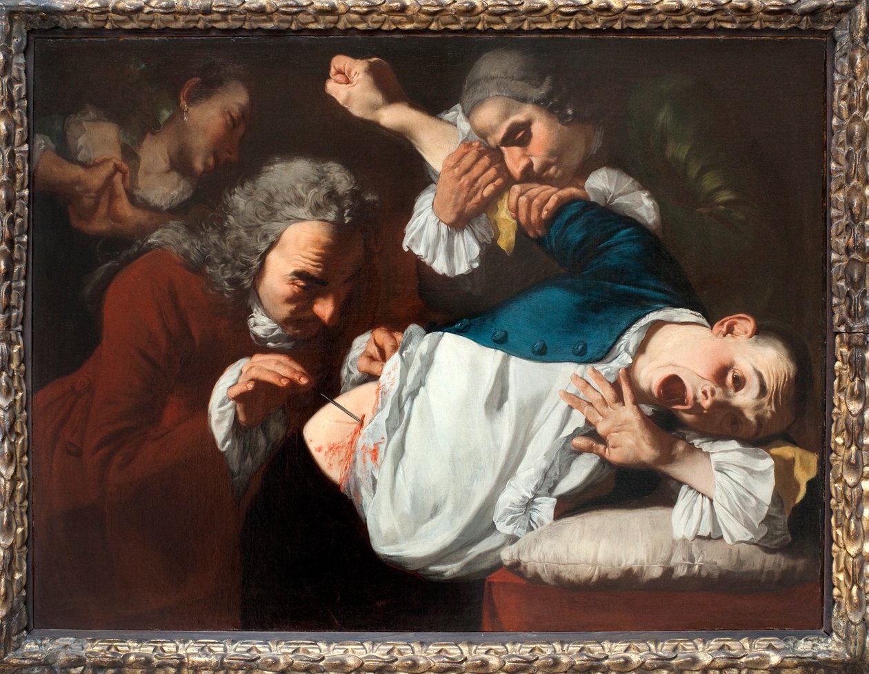 The Operation by Gaspare Traversi