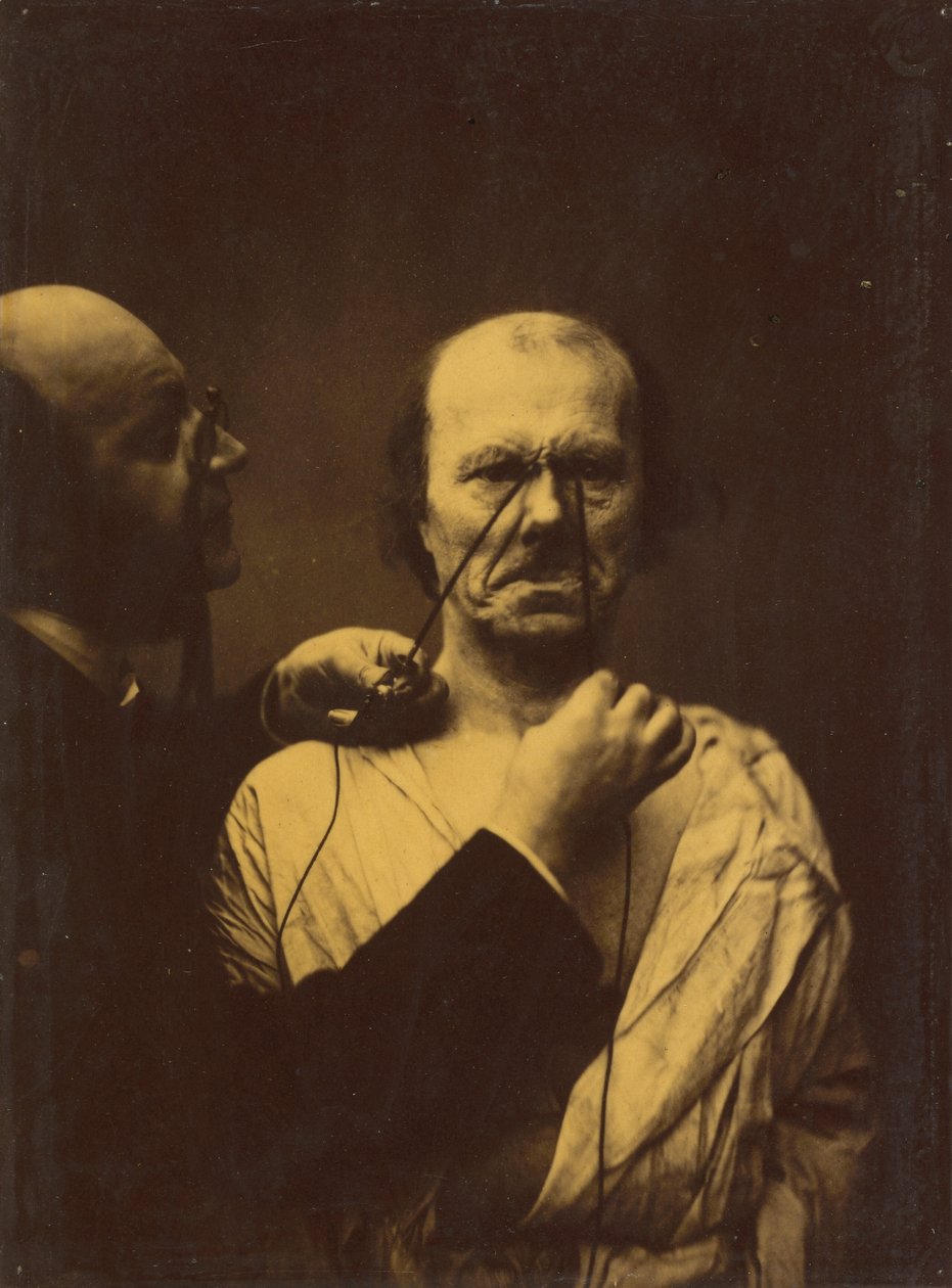 Aggression, Wickedness by Guillaume Benjamin Amant Duchenne