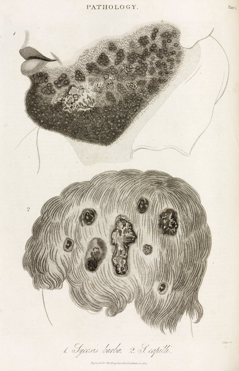 Skin Diseases by John Pardon