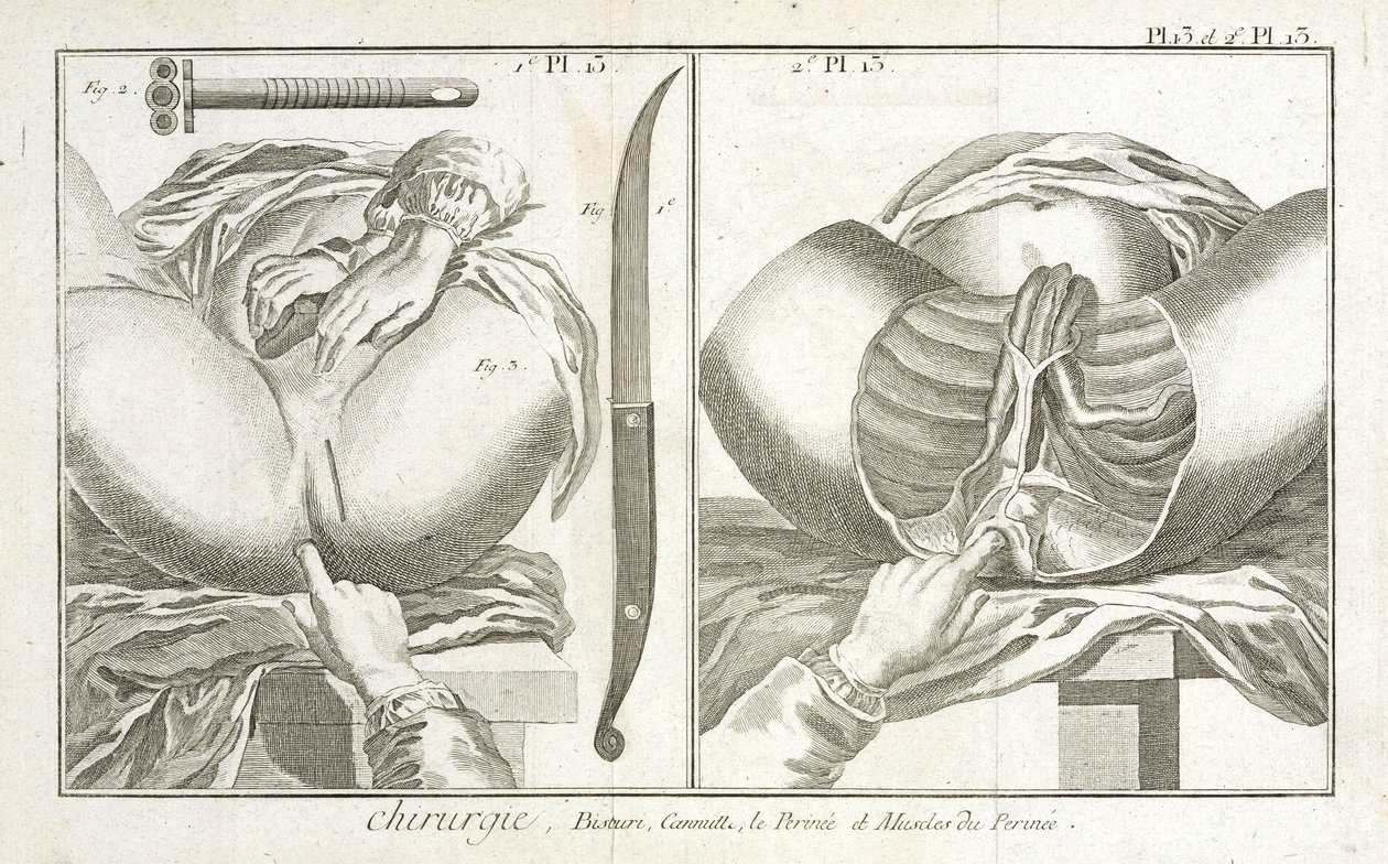 Early-Modern Equipment by Unbekannt
