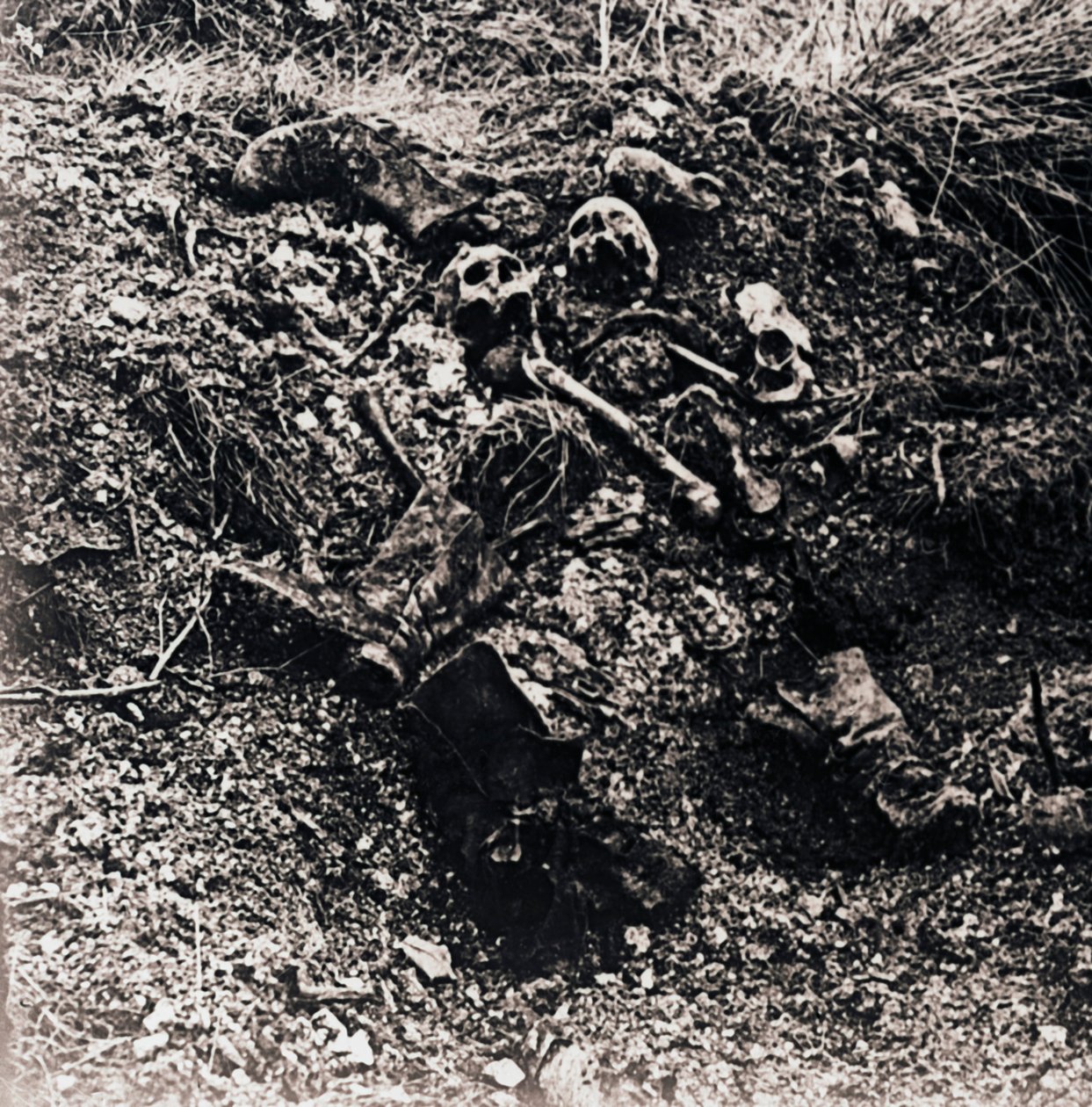 Human Remains by Unbekannt