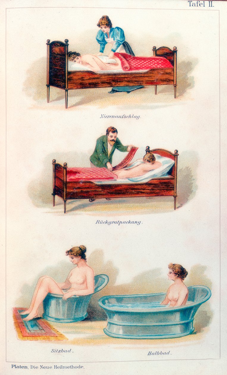 Hydrotherapy Treatments by Unbekannt