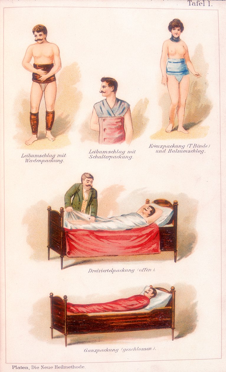 Hydrotherapy treatments by Unbekannt