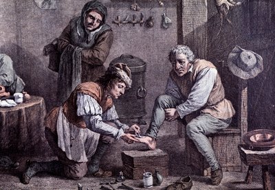 A surgery operation (engraving) by Anonymous Anonymous