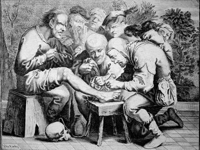 Ankle surgery (engraving) by Anonymous Anonymous