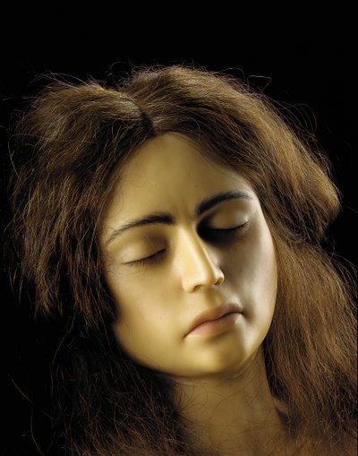 Anatomical model of an ovarian pregnancy (detail) by European School