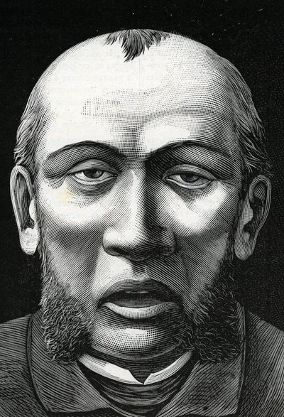 Patient with cerebral softening (engraving, 1888) by French School