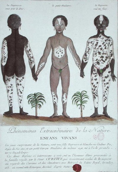 The Phenomenon of Leukoderma by French School