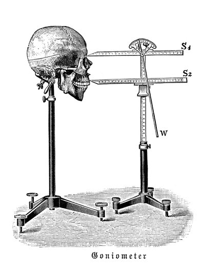 Goniometer Measuring Human Skull by German School