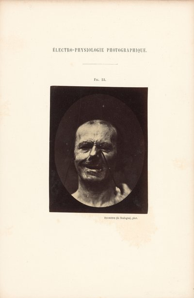 Electro-Physiological Photography, Figure 53 by Guillaume Benjamin Duchenne