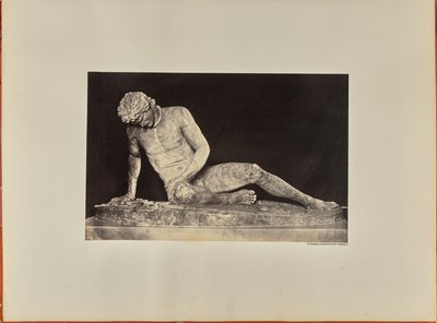 The Dying Gladiator, Front View (Capitol) by James Anderson
