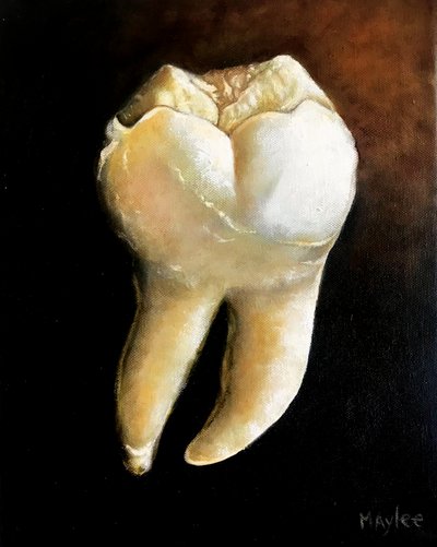 The molar, 2022 by Maylee Christie