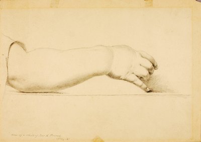 Arm of Child of Hiram Powers by Miner Kilbourne Kellogg