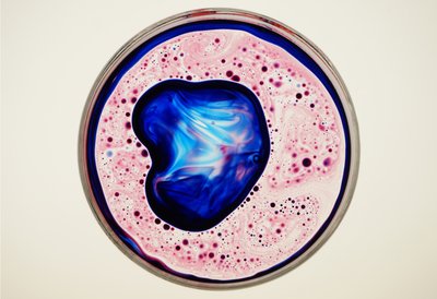 Petri Dish by Steve Pavlovsky