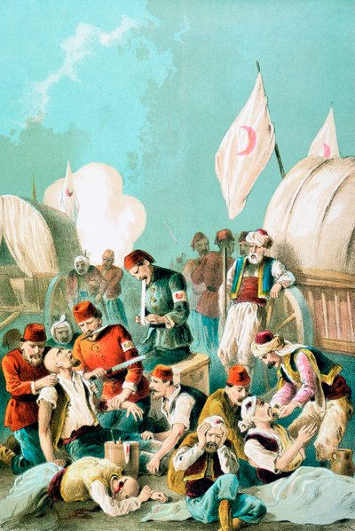 Arm being amputated without anaesthetic, Russo-Turkish War, 1877 by Unbekannt