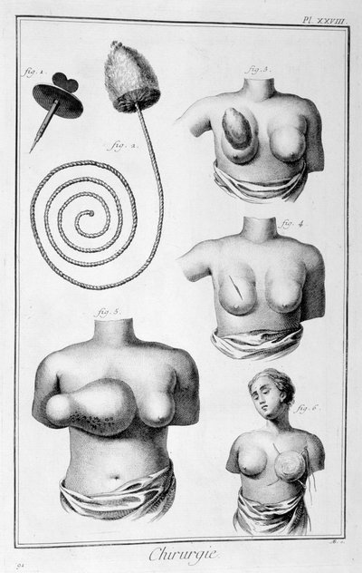 Breast Surgery by Unbekannt