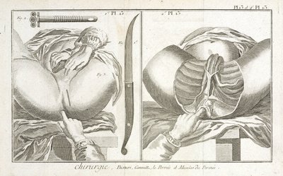 Early-Modern Equipment by Unbekannt
