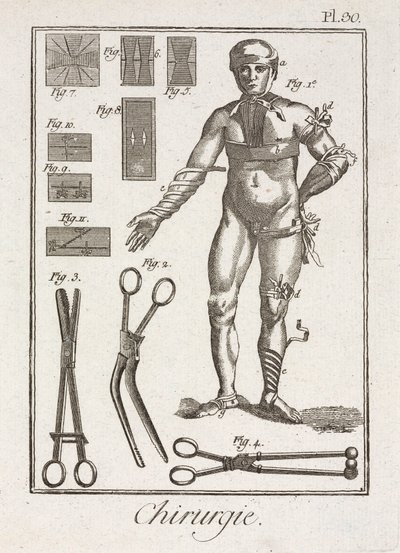Early-Modern Bandaging a Human Figure by Unbekannt
