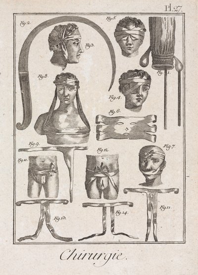 Early-Modern Bandaging after Surgery by Unbekannt