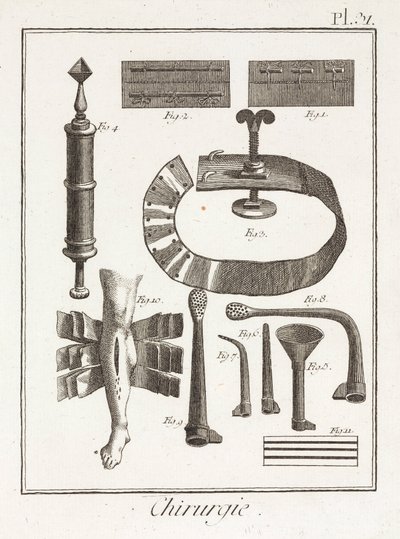 Early-Modern Surgical Devices by Unbekannt
