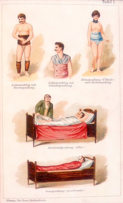 Hydrotherapy treatments by Unbekannt
