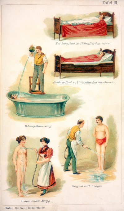 Hydrotherapy treatments by Unbekannt