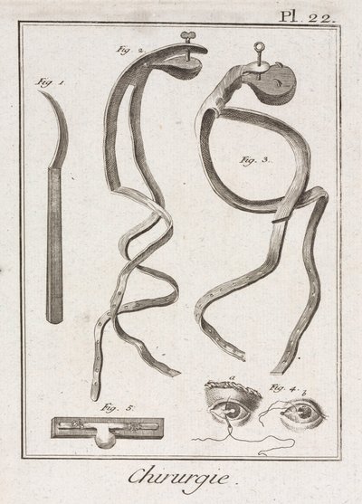 Equipment, Early-Modern Eye surgery by Unbekannt