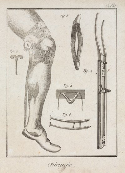 Early-Modern Surgical Supports by Unbekannt