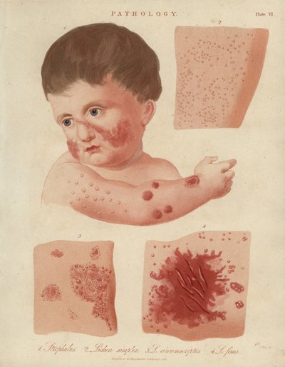 Skin Diseases of Infants by Unbekannter Künstler