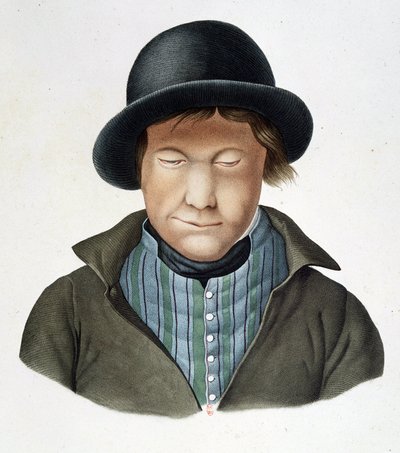 Lepers of Iceland, circa 1840 by Unknown artist