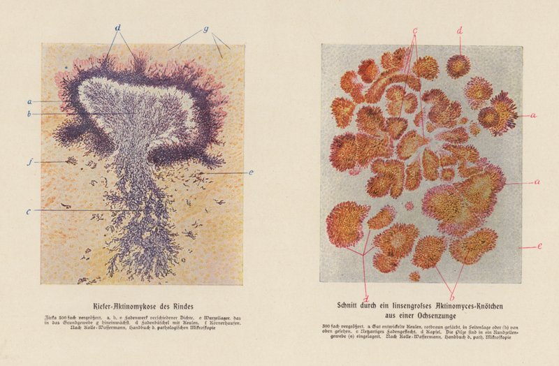 Actinomyces bovis by German School