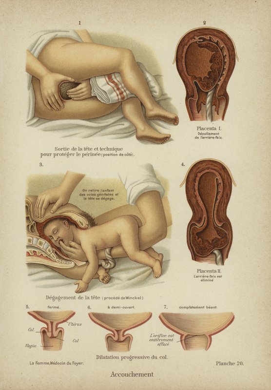 Childbirth by German School