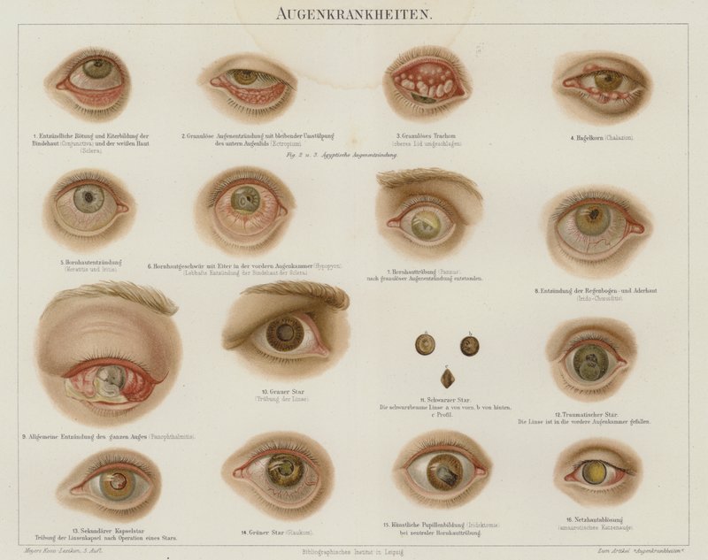 Eye disorders by German School