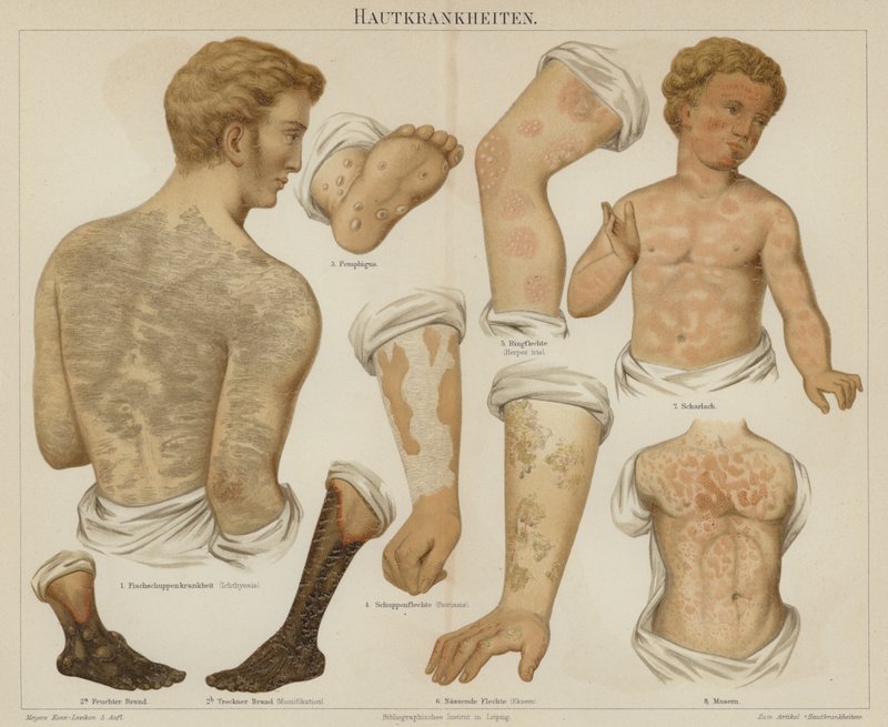 Skin disorders by German School